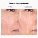 INSTANT FILLER 5X PURE HYALURONIC 15ML
